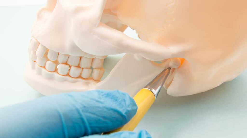 tmj-disorders
