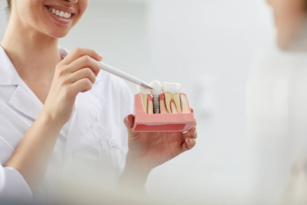 Model of dental implant