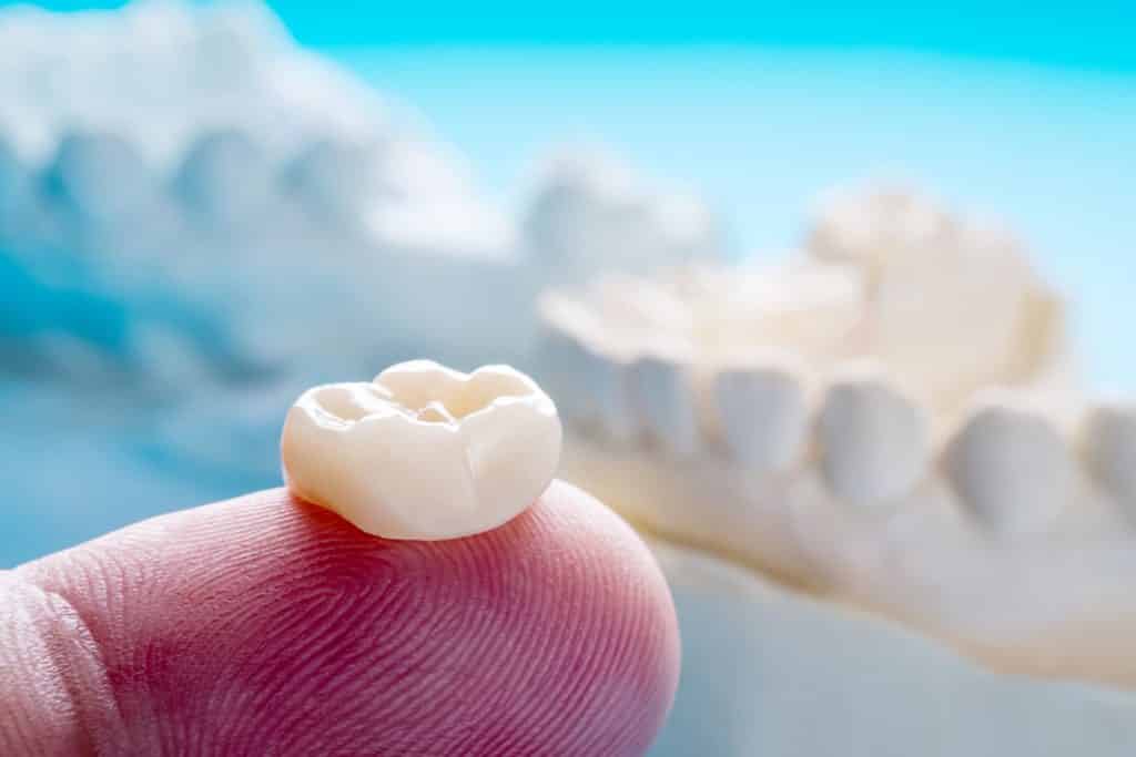 What is a Dental Tooth Crown